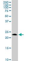 Anti-GCSAM Mouse Monoclonal Antibody [clone: 1.00E+09]