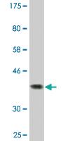 Anti-SRPK1 Mouse Monoclonal Antibody [clone: 3A11]