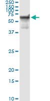 Anti-STK33 Antibody Pair