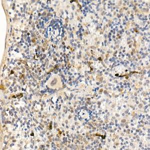 Immunohistochemistry analysis of paraffin-embedded mouse spleen using Anti-ABL1 Antibody (A12600) at a dilution of 1:20 (40x lens) Perform high pressure antigen retrieval with 10 mM citrate buffer pH 60 before commencing with IHC staining protocol