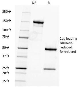 SDS-PAGE analysis of Anti-Fascin Antibody [FSCN1/416] under non-reduced and reduced conditions; showing intact IgG and intact heavy and light chains, respectively. SDS-PAGE analysis confirms the integrity and purity of the antibody