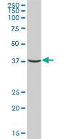 Anti-EMC8 Mouse Polyclonal Antibody