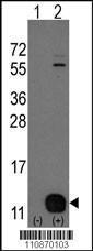 Anti-PHPT1 Rabbit Polyclonal Antibody (HRP (Horseradish Peroxidase))