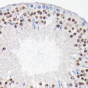 Immunohistochemistry analysis of paraffin-embedded rat testis using Anti-PI 3 Kinase p85 beta Antibody [ARC0287] (A308231) at a dilution of 1:100 (40X lens). Perform microwave antigen retrieval with 10 mM Tris/EDTA buffer pH 9.0 before commencing with IHC staining protocol