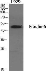 Anti-FBLN5 antibody