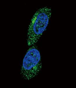 Anti-MHC Class 1 Chain-related Gene A Rabbit Polyclonal Antibody (AP (Alkaline Phosphatase))