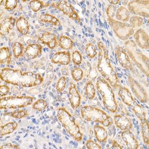 Immunohistochemistry analysis of paraffin-embedded rat kidney using Anti-ABL1 Antibody (A12600) at a dilution of 1:20 (40x lens) Perform high pressure antigen retrieval with 10 mM citrate buffer pH 60 before commencing with IHC staining protocol