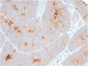 Anti-ECM1 Rabbit Recombinant Antibody [clone: ECM1/2889R]