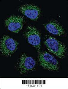 Anti-GSR Rabbit Polyclonal Antibody