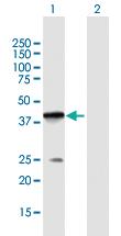 Anti-POLB Mouse Polyclonal Antibody