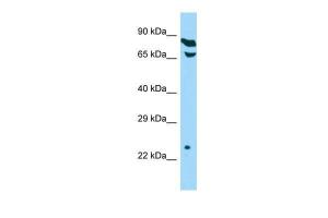 Anti-THOC7 Rabbit Polyclonal Antibody