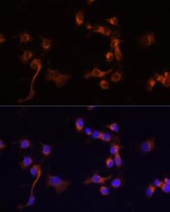 Immunofluorescence analysis of A431 cells using Anti-ABL1 Antibody (A12600) at a dilution of 1:100 (40x lens) DAPI was used to stain the cell nuclei (blue)