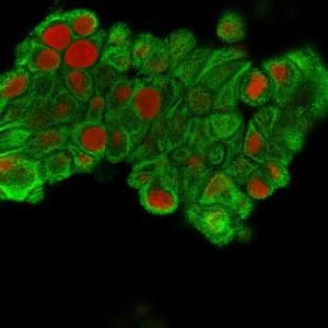 Immunofluorescent analysis of methanol fixed MCF-7 cells stained with Anti-Cytokeratin 19 Antibody [SPM561] followed by Goat Anti-Mouse IgG (CF and #174; 488) (Green). The nuclear counterstain is RedDot (Red)