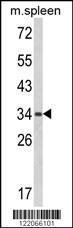 Anti-HLA-B-associated Transcript 4 Rabbit Polyclonal Antibody (AP (Alkaline Phosphatase))