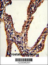 Anti-PSMB9 Rabbit Polyclonal Antibody (FITC (Fluorescein))