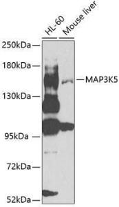 Western blot analysis of extracts of various cell lines, using Anti-ASK1 Antibody (A12601) at 1:1,000 dilution. The secondary antibody was Goat Anti-Rabbit IgG H&L Antibody (HRP) at 1:10,000 dilution.