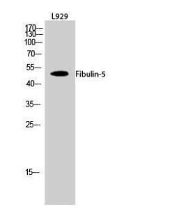 Anti-FBLN5 antibody