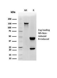 SDS-PAGE analysis of Anti-CD48 Antibody [CD48/4785] under non-reduced and reduced conditions; showing intact IgG and intact heavy and light chains, respectively. SDS-PAGE analysis confirms the integrity and purity of the antibody