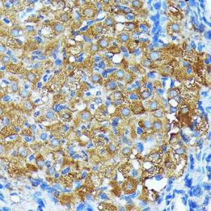 Immunohistochemistry analysis of paraffin-embedded rat ovary using Anti-Leptin Receptor Antibody [ARC0454] (A305700) at a dilution of 1:100 (40x lens). Perform microwave antigen retrieval with 10 mM PBS buffer pH 7.2 before commencing with IHC staining protocol.