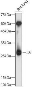 Antibody anti-IL6 100 µl