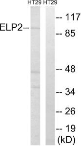 Western blot analysis of lysates from HT-29 cells using Anti-ELP2 Antibody. The right hand lane represents a negative control, where the antibody is blocked by the immunising peptide.