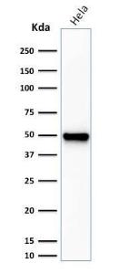 Western blot analysis of HeLa cell lysate using Anti-Fascin Antibody [FSCN1/416]