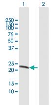 Anti-CNTF Rabbit Polyclonal Antibody