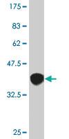 Anti-ROBO1 Mouse Monoclonal Antibody [clone: 1F8]