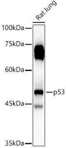 Western blot analysis of extracts of Rat lung, using Anti-p53 Antibody (A307214) at 1:1,000 dilution The secondary antibody was Goat Anti-Rabbit IgG H&L Antibody (HRP) at 1:10,000 dilution Lysates/proteins were present at 25 µg per lane