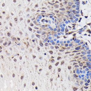 Immunohistochemistry analysis of paraffin-embedded human esophageal using Anti-PI 3 Kinase p85 beta Antibody [ARC0287] (A308231) at a dilution of 1:100 (40X lens). Perform microwave antigen retrieval with 10 mM Tris/EDTA buffer pH 9.0 before commencing with IHC staining protocol