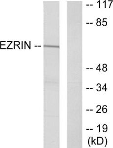 Antibody anti-EZRIN A97548-100 100 µg