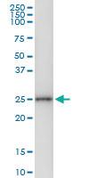 Anti-CNTF Rabbit Polyclonal Antibody