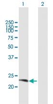 Anti-RAB38 Mouse Polyclonal Antibody