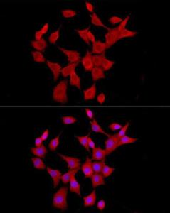 Antibody anti-IL6 100 µl