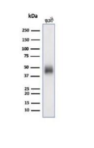 Western blot analysis of Raji cell line lysate using Anti-CD48 Antibody [CD48/4785]