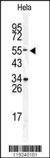 Anti-DONSON Rabbit Polyclonal Antibody