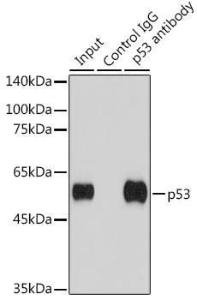 Immunoprecipitation analysis of 200 µg extracts of 293T cells using 3 µg of Anti-p53 Antibody (A307214) This Western blot was performed on the immunoprecipitate using Anti-p53 Antibody (A307214) at a dilution of 1:2000