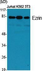 Antibody anti-EZRIN A97548-100 100 µg