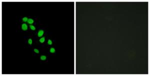 Immunofluorescence analysis of HepG2 cells using Anti-IRX2 Antibody. The right hand panel represents a negative control, where the antibody was pre-incubated with the immunising peptide