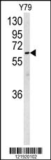 Anti-ACSL4 Rabbit Polyclonal Antibody