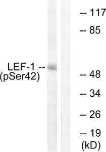 Antibody anti-LEF-1 phospho SER42 100 µg