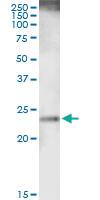 Anti-RAB38 Rabbit Polyclonal Antibody