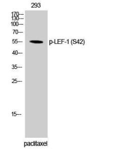 Antibody anti-LEF-1 phospho SER42 100 µg