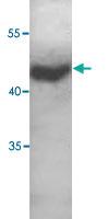 Anti-TNFRSF19 Rabbit Polyclonal Antibody