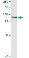 Anti-SRPK1 Polyclonal Antibody Pair