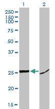 Anti-HMGB1 Mouse Monoclonal Antibody [clone: 1D5]