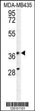 Anti-KPRA Rabbit Polyclonal Antibody (Biotin)