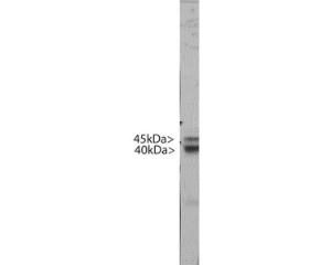 Rat brain extract from a postnatal 3 day animal. Two bands at ~45 kDa and ~35 kDa show that the mouse anti-DCX antibody binds to an epitope in the region of DCX shared by Lis-A, and Lis-B, Lis-C and Lis-D, the C terminal 360 amino acids of Lis-A.