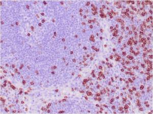 Immunohistochemical analysis of formalin-fixed, paraffin-embedded human tonsil using Anti-CD8A Antibody [C8/468]