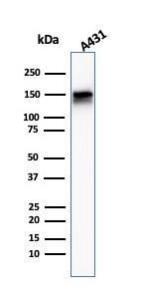 Anti-EGFR antibody